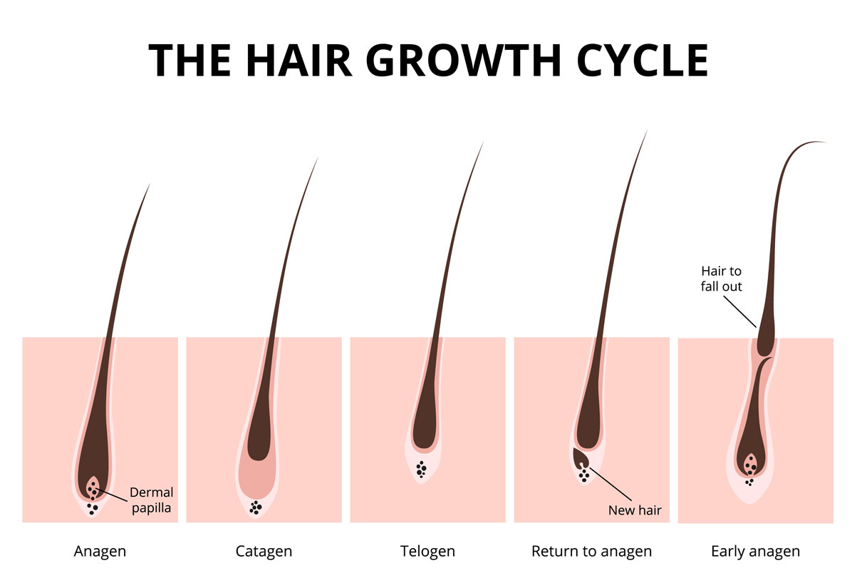 hair loss