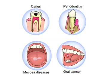 Ketahui Pentingnya Menjaga Kebersihan dan Kesehatan Gigi & Mulut | Rumah  Sakit EMC